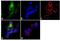 Integrin Subunit Beta 3 antibody, GTX25190, GeneTex, Immunofluorescence image 