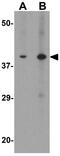 Tribbles Pseudokinase 3 antibody, GTX31610, GeneTex, Western Blot image 