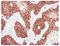 ERBB2 antibody, AM33014PU-N, Origene, Immunohistochemistry paraffin image 