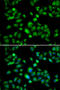 Membrane Bound Transcription Factor Peptidase, Site 1 antibody, 14-958, ProSci, Immunofluorescence image 