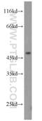 Tripartite Motif Containing 14 antibody, 15742-1-AP, Proteintech Group, Western Blot image 