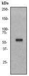 Keratin 10 antibody, ab76318, Abcam, Western Blot image 