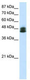 Zinc Finger Protein 785 antibody, TA341483, Origene, Western Blot image 