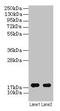 ATP Synthase F1 Subunit Delta antibody, CSB-PA00635A0Rb, Cusabio, Western Blot image 