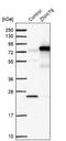 Zinc Finger HIT-Type Containing 6 antibody, NBP1-88683, Novus Biologicals, Western Blot image 