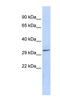 Pyridoxal Phosphatase antibody, NBP1-56888, Novus Biologicals, Western Blot image 