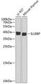 Interleukin 18 Binding Protein antibody, 22-228, ProSci, Western Blot image 
