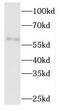 Tubulin Folding Cofactor E antibody, FNab08520, FineTest, Western Blot image 