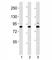 SUZ12 Polycomb Repressive Complex 2 Subunit antibody, F53232-0.4ML, NSJ Bioreagents, Western Blot image 