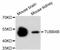 Tubulin Beta 4B Class IVb antibody, abx125403, Abbexa, Western Blot image 