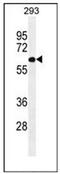 PAT1 Homolog 2 antibody, AP53173PU-N, Origene, Western Blot image 