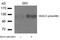 Histone Deacetylase 5 antibody, 79-192, ProSci, Western Blot image 