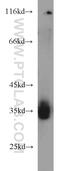 Translocase Of Inner Mitochondrial Membrane Domain Containing 1 antibody, 23622-1-AP, Proteintech Group, Western Blot image 