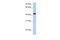 Ectodysplasin A Receptor antibody, PA5-43404, Invitrogen Antibodies, Western Blot image 