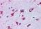 Alsin Rho Guanine Nucleotide Exchange Factor ALS2 antibody, orb18466, Biorbyt, Immunohistochemistry paraffin image 