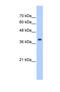 Eukaryotic Translation Initiation Factor 3 Subunit M antibody, NBP1-56654, Novus Biologicals, Western Blot image 