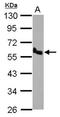 Plasminogen Activator, Urokinase Receptor antibody, orb13650, Biorbyt, Western Blot image 