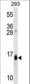 Regulator Of G Protein Signaling 8 antibody, LS-C162583, Lifespan Biosciences, Western Blot image 