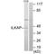 ILK Associated Serine/Threonine Phosphatase antibody, A08074, Boster Biological Technology, Western Blot image 