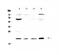 Kallikrein Related Peptidase 2 antibody, A03879, Boster Biological Technology, Western Blot image 