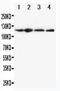 NLR Family Pyrin Domain Containing 3 antibody, PA1665, Boster Biological Technology, Western Blot image 