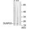 Dual Specificity Phosphatase 22 antibody, PA5-49882, Invitrogen Antibodies, Western Blot image 