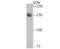 Ribonuclease 3 antibody, NBP2-75475, Novus Biologicals, Western Blot image 