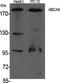 ATP Binding Cassette Subfamily A Member 8 antibody, A08490-1, Boster Biological Technology, Western Blot image 