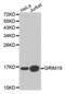 NADH dehydrogenase [ubiquinone] 1 alpha subcomplex subunit 13 antibody, abx001668, Abbexa, Western Blot image 