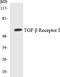 Transforming Growth Factor Beta Receptor 1 antibody, LS-C200779, Lifespan Biosciences, Western Blot image 