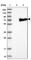 Acyloxyacyl Hydrolase antibody, HPA026716, Atlas Antibodies, Western Blot image 