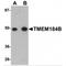 Transmembrane Protein 184B antibody, MBS150941, MyBioSource, Western Blot image 