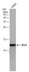 Selenoprotein K antibody, GTX131124, GeneTex, Western Blot image 