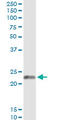 Endothelin 1 antibody, LS-C197103, Lifespan Biosciences, Immunoprecipitation image 