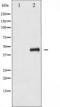 SEK1 antibody, TA325642, Origene, Western Blot image 
