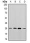 Phosphoglycerate Mutase 2 antibody, orb341390, Biorbyt, Western Blot image 