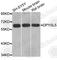 CRAM antibody, A2878, ABclonal Technology, Western Blot image 