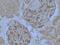 WT1 Transcription Factor antibody, NB110-60011, Novus Biologicals, Immunohistochemistry paraffin image 