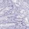 M-Phase Specific PLK1 Interacting Protein antibody, NBP2-31718, Novus Biologicals, Immunohistochemistry paraffin image 