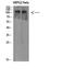 NLR Family Member X1 antibody, A04980-1, Boster Biological Technology, Western Blot image 