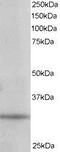 Phosphatidylinositol Transfer Protein Alpha antibody, NB100-1413, Novus Biologicals, Western Blot image 