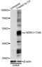 N-Myc Downstream Regulated 1 antibody, LS-C750599, Lifespan Biosciences, Western Blot image 