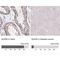 Nucleoporin 85 antibody, NBP2-31860, Novus Biologicals, Immunohistochemistry paraffin image 