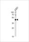 Paired Box 6 antibody, LS-C163394, Lifespan Biosciences, Western Blot image 
