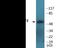 Activating Transcription Factor 2 antibody, EKC2214, Boster Biological Technology, Western Blot image 