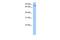 Tetratricopeptide Repeat Domain 14 antibody, GTX47222, GeneTex, Western Blot image 