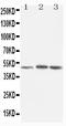Nuclear Receptor Subfamily 1 Group H Member 3 antibody, PA1246, Boster Biological Technology, Western Blot image 