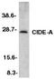 Cell Death Inducing DFFA Like Effector A antibody, ab8402, Abcam, Western Blot image 