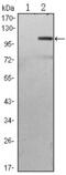 TGF-Beta Activated Kinase 1 (MAP3K7) Binding Protein 2 antibody, GTX82751, GeneTex, Western Blot image 