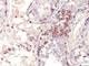 MAGE Family Member A1 antibody, NBP2-44506, Novus Biologicals, Immunohistochemistry frozen image 